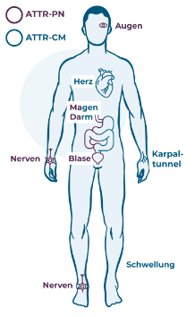 Laien betroffene Organe PN CM